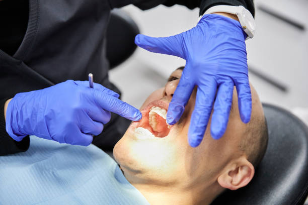 Best Emergency Root Canal Treatment in Youngsville, NC