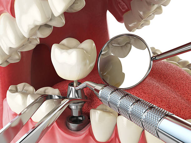 Best Emergency Dental Care for Broken or Chipped Teeth in Youngsville, NC
