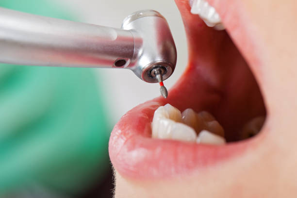 Reliable NC Emergency Dentist Solutions